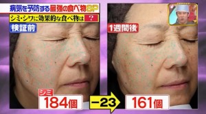 シミが２３個も減ったという画像キャプチャ