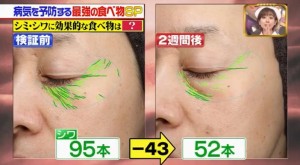 ２週間でシワが４３個も減った画像キャプチャ