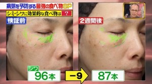 ２週間でシワが９個減った画像キャプチャ